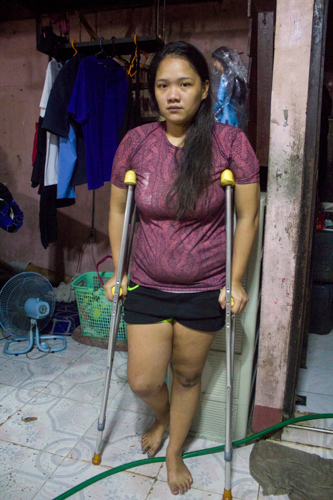 Through sessions of physical therapy, Micholle Manila progressed from not being able to stand to using a wheelchair then crutches.【Photo by Matt Serrano】