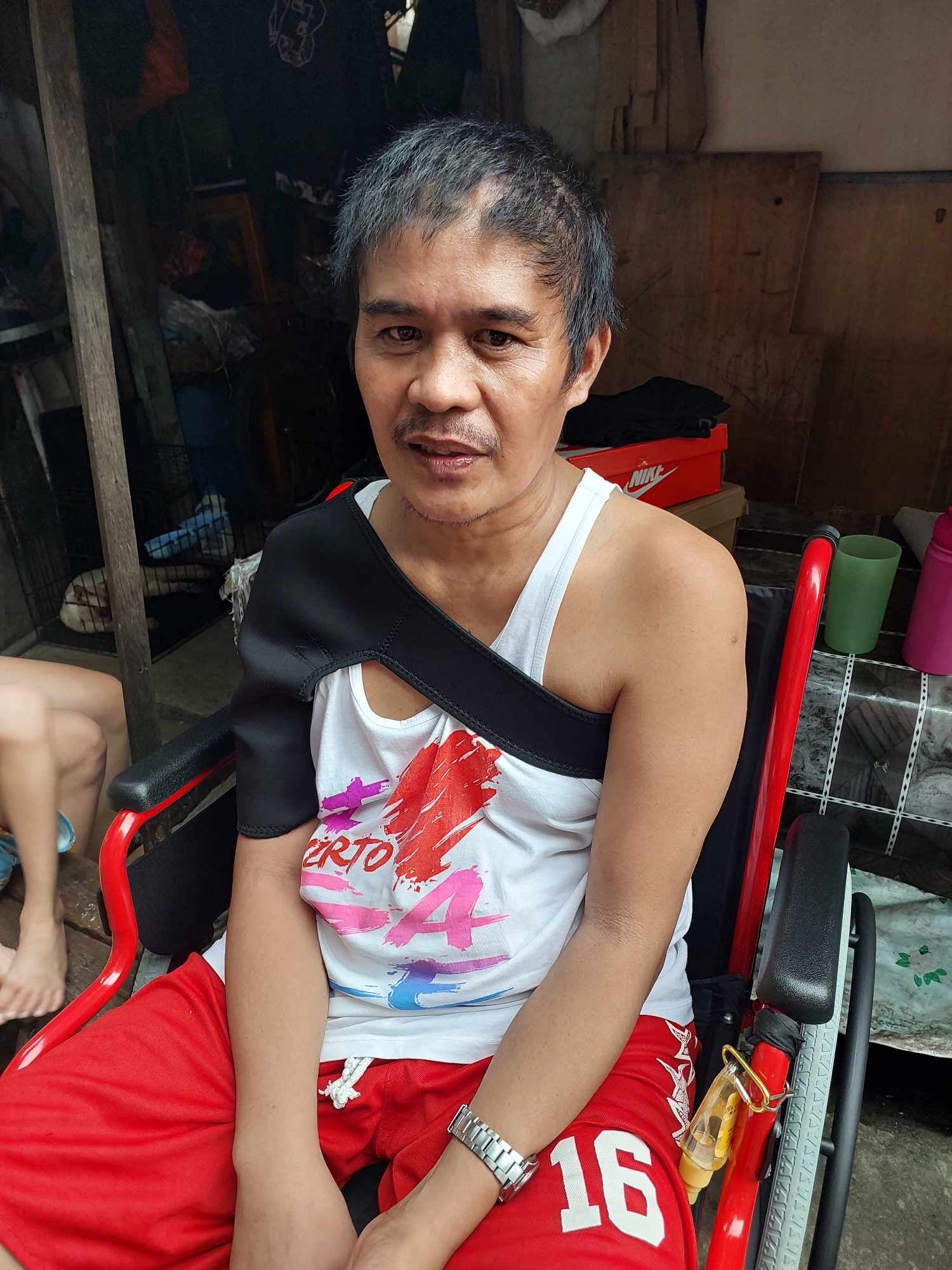 Elmer Juampit recovers at home after undergoing surgery to treat his arteriovenous malformation (AVM) and unruptured aneurysm.