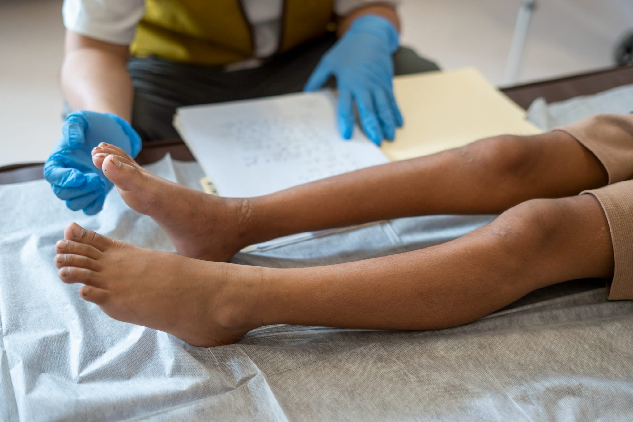 Jamaica Gillado was cleared to return home with instructions to continue daily foot exercises. During physical therapy, her family learned how to assist her with these exercises.