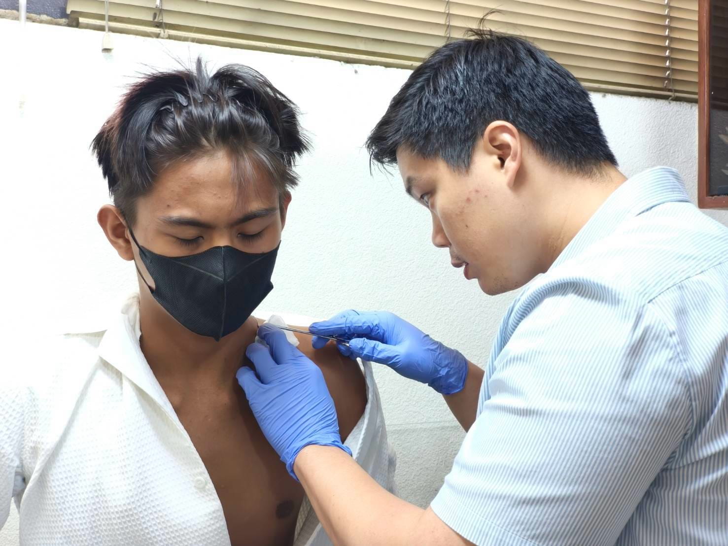 On September 4, 2026, Dr. James Martin Qua examined Gabriel Casapao’s neck mass and determined that it contained pus caused by pulmonary tuberculosis (PTB). 