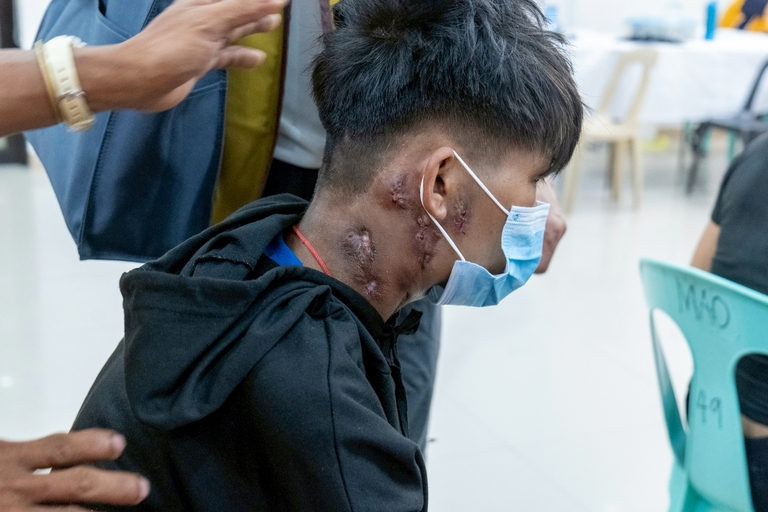 Skin conditions, infections, and malnutrition were among the most common health problems observed during the medical mission.
