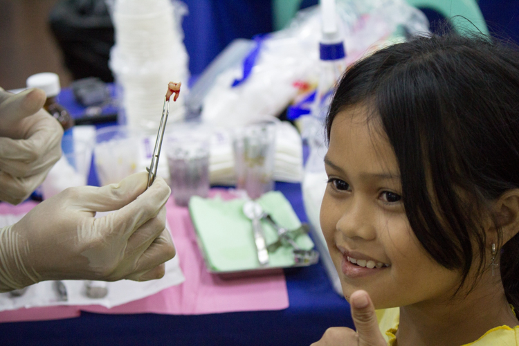 A girl gives a thumbs up sign after her successful tooth extraction. 【Photo by Marella Saldonido】