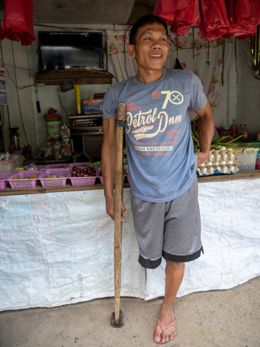Rodello Garillo lost most of his right leg while helping victims of a road accident in 2007. Debris from an explosion of a truck carrying liquid sodium dioxide was embedded on his upper thigh, resulting in a life-threatening infection. Without the amputation, he would have died.