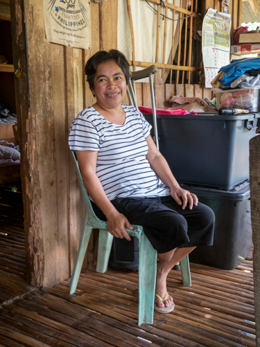 A diabetic, Arlyn Segarra developed gangrene and was forced to have her lower right leg amputated to save her life in June 2023.