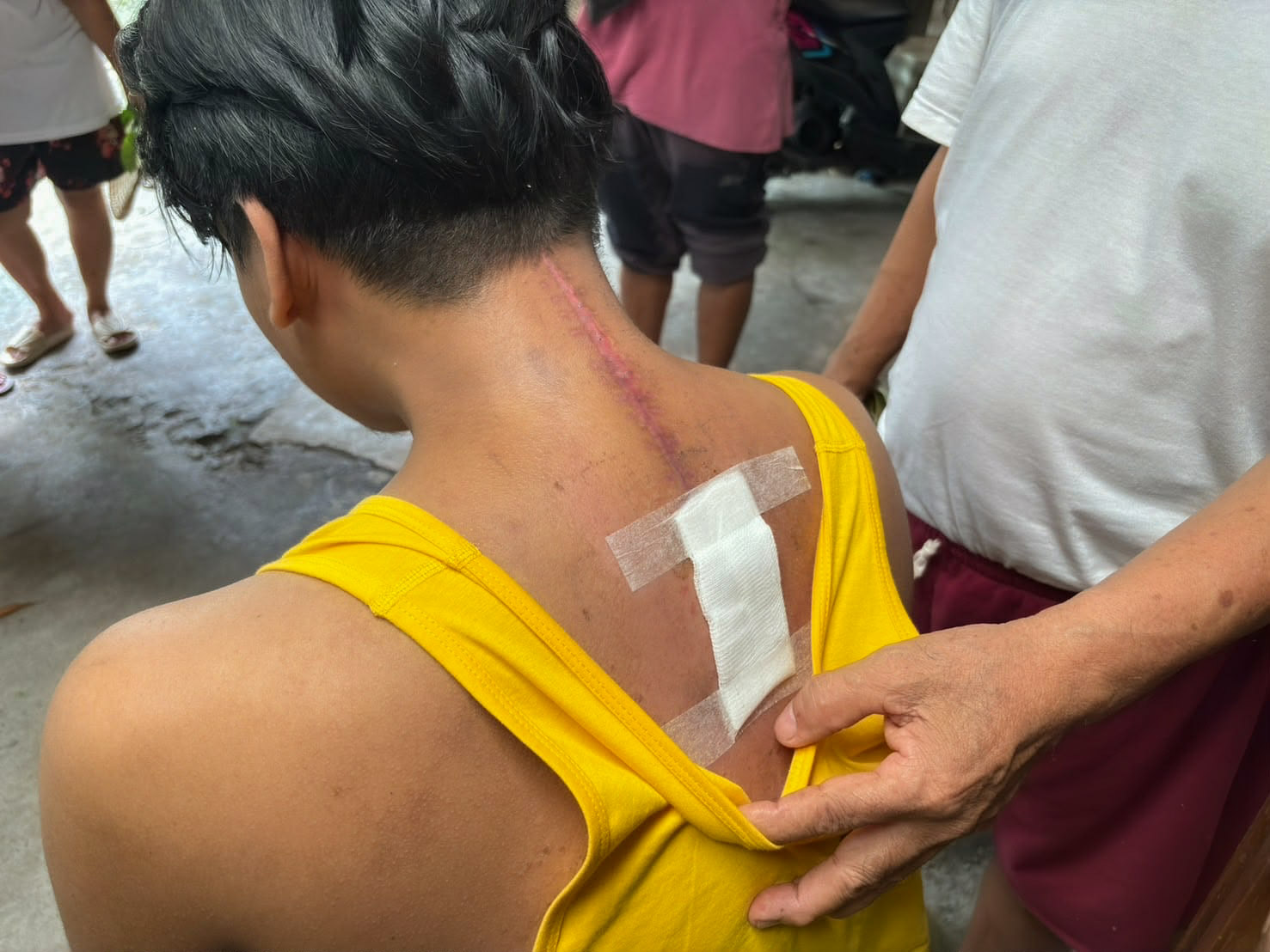 Don successfully underwent surgery to remove a  spinal tumor, followed by the placement of a spinal implant to stabilize his condition. 