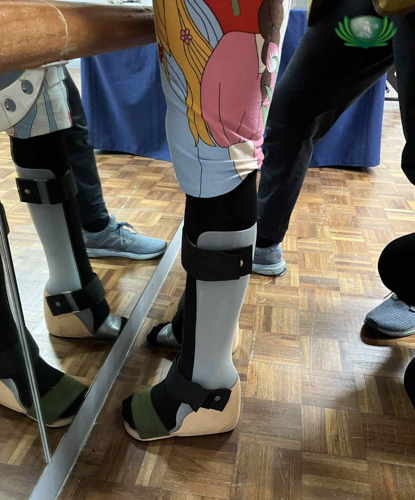 Leg braces, which Rica Serrano received with help from Tzu Chi, help her stand and walk.