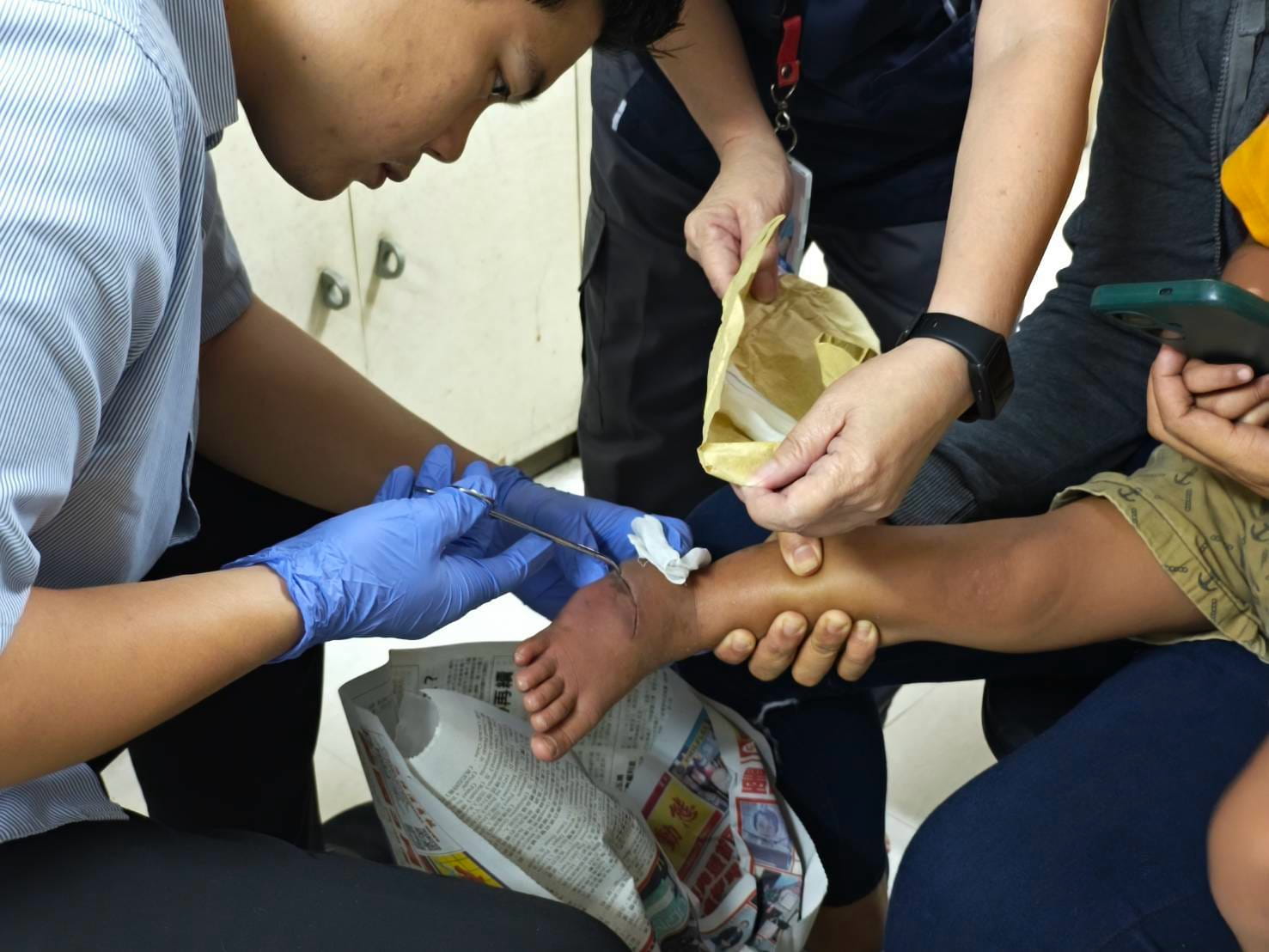 From September 2 to 7, Cyril Asher Aguila was at CGHMC for follow-up consultations and wound cleaning. 