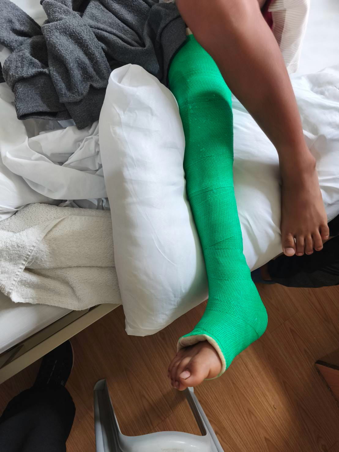 Jamaica Gillado was advised to wear the cast for six weeks.
