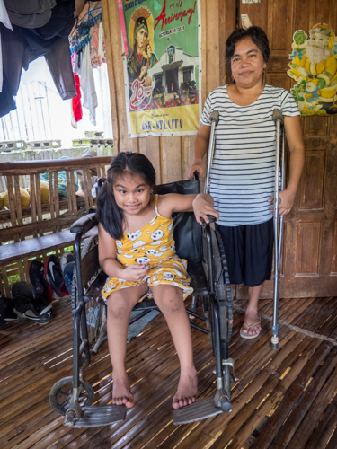 Amputated on the right leg below the knee, Arlyn Segarra finds it difficult to handle household chores and care for her youngest, a daughter with cerebral palsy.