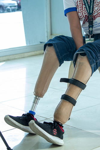 Wholeheartedly grateful, Nene shows her prostheses that help her with her duties at the Provincial Health Office. 【Photo by Marella Saldonido】