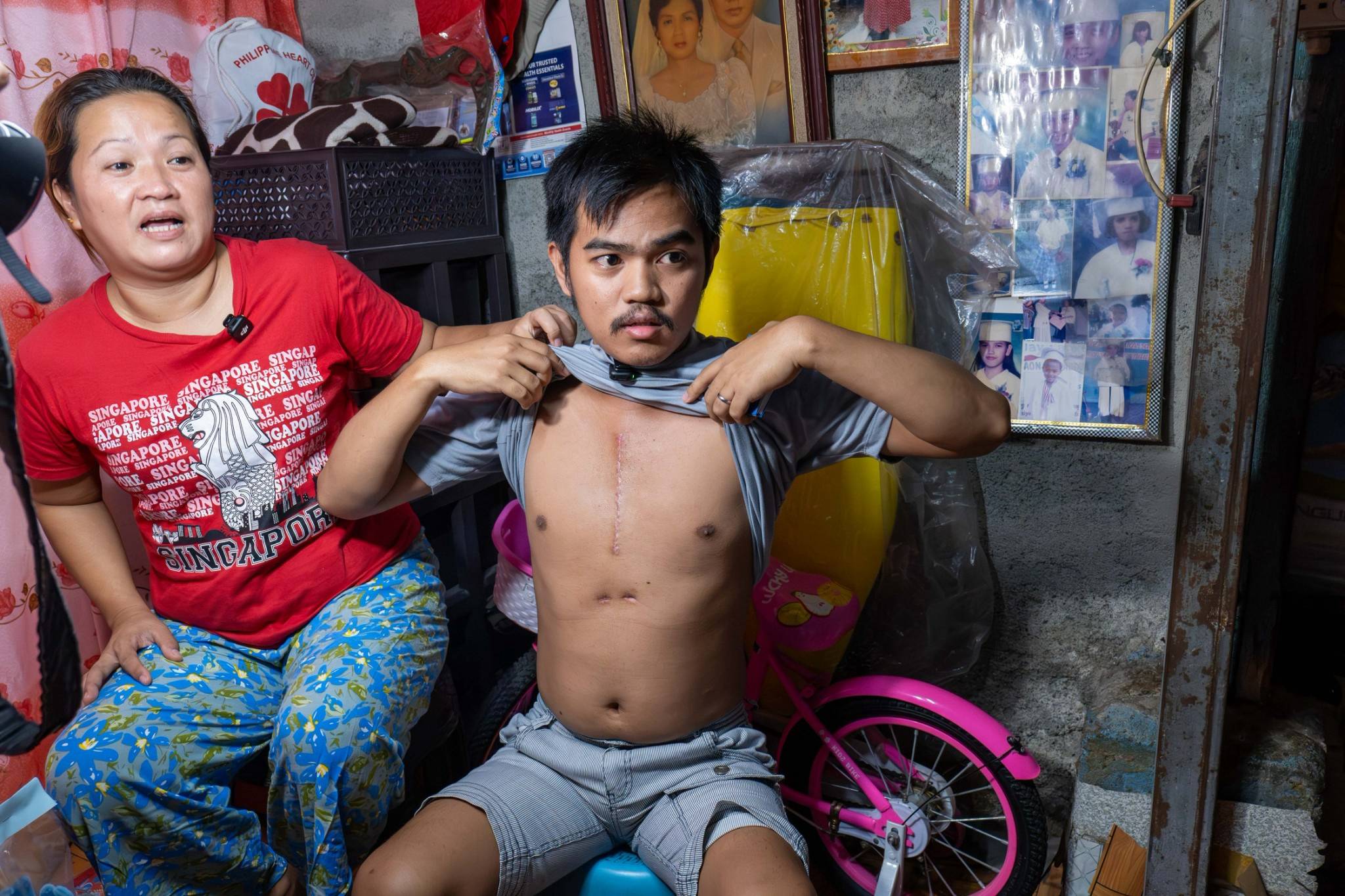 Paul Christian Sacdalan raises his shirt to show the scar of his successful open-heart surgery: “Before, my heart was always pounding. Now, I can finally walk with so much ease.”