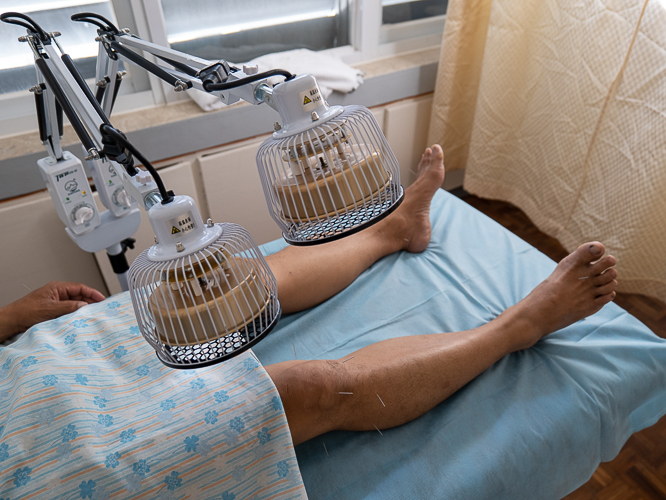 Acupuncture, a practice rooted in traditional Chinese medicine (TCM), entails the insertion of thin needles into specific points on the body to promote the flow of energy, known as 'Qi.'【Photo by Jeaneal Dando】