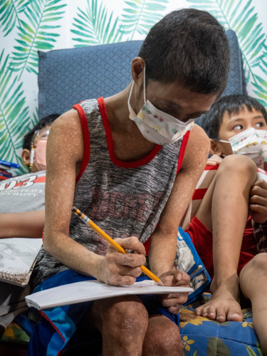 Jasper, 26, has Fanconi anemia, a rare disorder that gives him his small stature and blotches on his skin. He also has a missing right thumb and is hard of hearing. 【Photo by Matt Serrano】